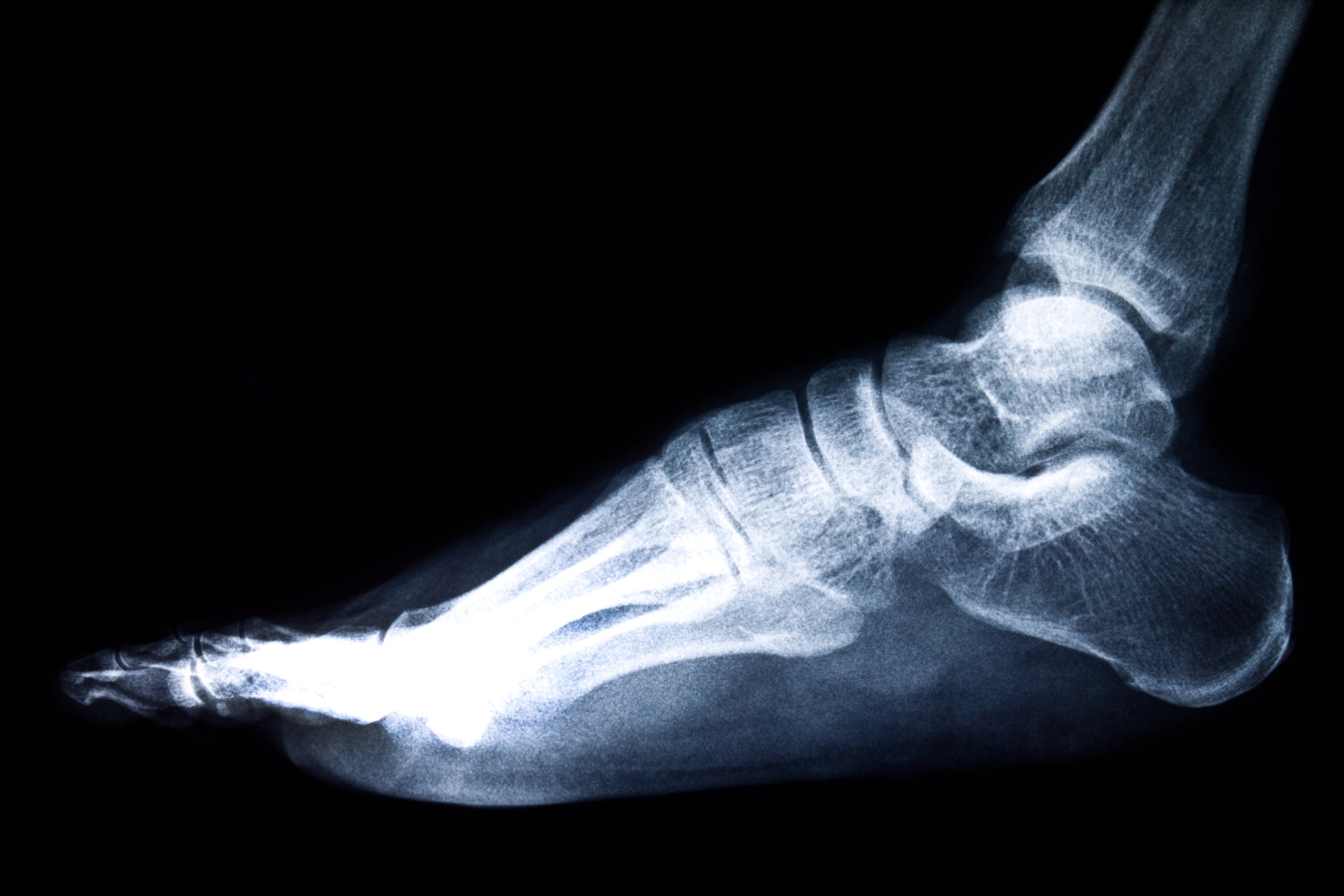 Digital X-rays at our podiatry office