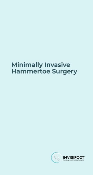 InvisiFoot Minimally Invasive Hammertoe Surgery